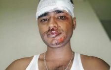 গোয়াইনঘাটে চোরাকারবারিদের হামলায় সংবাদকর্মী আহত