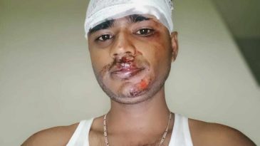 গোয়াইনঘাটে চোরাকারবারিদের হামলায় সংবাদকর্মী আহত