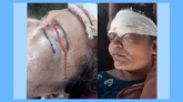 সিলেটে প্রতিপক্ষের হামলায়  মহিলা আহত..