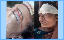 সিলেটে প্রতিপক্ষের হামলায়  মহিলা আহত..