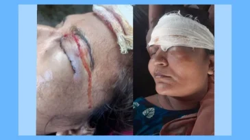 সিলেটে প্রতিপক্ষের হামলায়  মহিলা আহত..