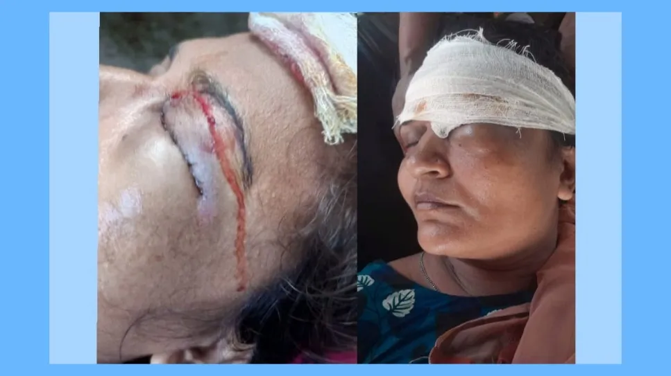 সিলেটে প্রতিপক্ষের হামলায়  মহিলা আহত..
