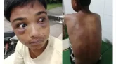 নির্যাতিত কিশোরের দুই চোখ ও চুরির মামলায় ফাঁসানোর মুল্য আড়াইল লক্ষ টাকা