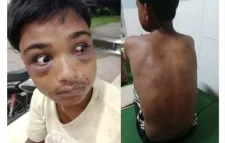 নির্যাতিত কিশোরের দুই চোখ ও চুরির মামলায় ফাঁসানোর মুল্য আড়াইল লক্ষ টাকা
