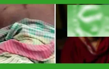 যুবকের লিঙ্গ কেটে দেন প্রেমিকা