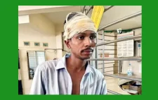 দায়িত্ব পালনকালে হামলার শিকার সিলেট সিটি কর্পোরেশনের এক কর্মচারী