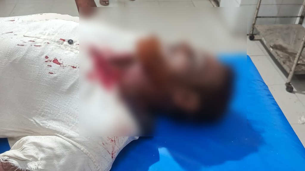 আমতলীতে ওষুধ ব্যবসায়ীকে হাতুড়ি–রড দিয়ে পিটিয়ে গুরুতর জখম, এক লাখ টাকা ছিনতাই