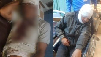মিরসরাইয়ে সাবেক ম্যাজিস্ট্রেটের গাড়িতে দুর্ধর্ষ ডাকাতি: ৫ জনকে কুপিয়ে জখম, ১ জন আইসিইউতে