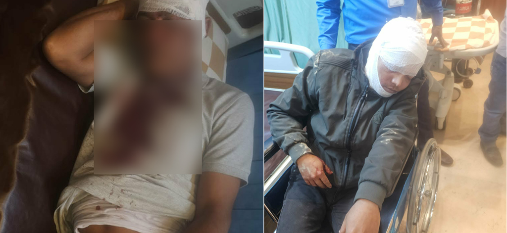 মিরসরাইয়ে সাবেক ম্যাজিস্ট্রেটের গাড়িতে দুর্ধর্ষ ডাকাতি: ৫ জনকে কুপিয়ে জখম, ১ জন আইসিইউতে