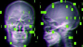 চিকিৎসায় এআই: আশীর্বাদ নাকি প্রাণঘাতী ঝুঁকি? রয়টার্সের অনুসন্ধানে চাঞ্চল্যকর তথ্য