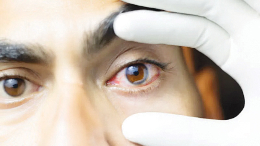 ছেলের পায়ে ভুল জুতো: এক বাবার দৃষ্টিশক্তি হারানো ও ঘুরে দাঁড়ানোর গল্প