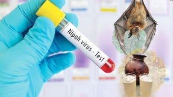 নওগাঁয় নিপাহ ভাইরাসে নারীর মৃত্যু: চলতি বছরে দেশে প্রথম প্রাণহানি