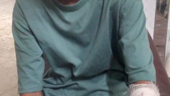 ছিনতাইকারী কর্তৃক আহত হয়ে ওসমানী মেডিকেলে ভর্তি আরমান