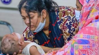 সিলেট বিভাগে হাম ও হামের উপসর্গে শিশু মৃত্যু