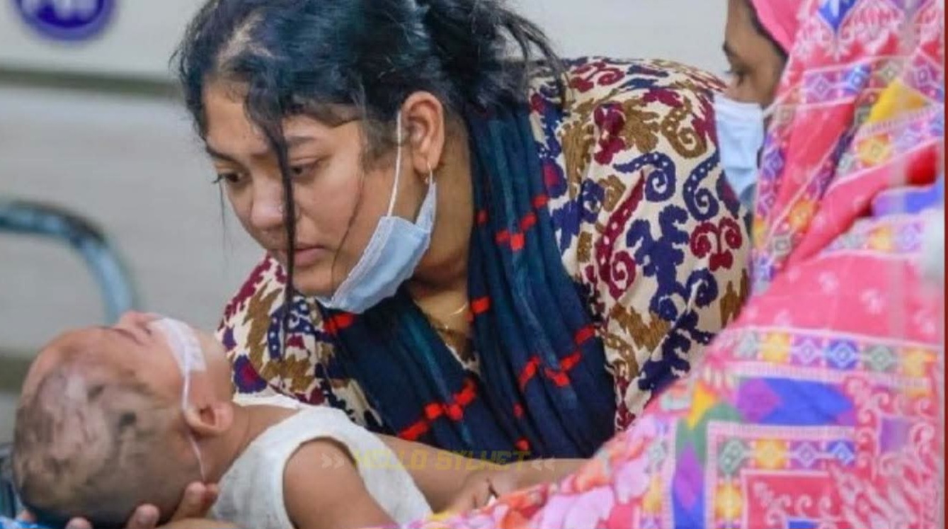 সিলেট বিভাগে হাম ও হামের উপসর্গে শিশু মৃত্যু