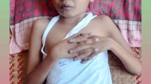 টাকার অভাবে থমকে গেছে শিশুটির চিকিৎসা, বাঁচতে চায় আবু সাঈদ