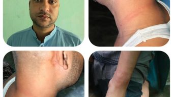 সিলেটের গোলাপগঞ্জে যুবককে হত্যার চেষ্টা, ৩৭ হাজার টাকা লুটের অভিযোগ