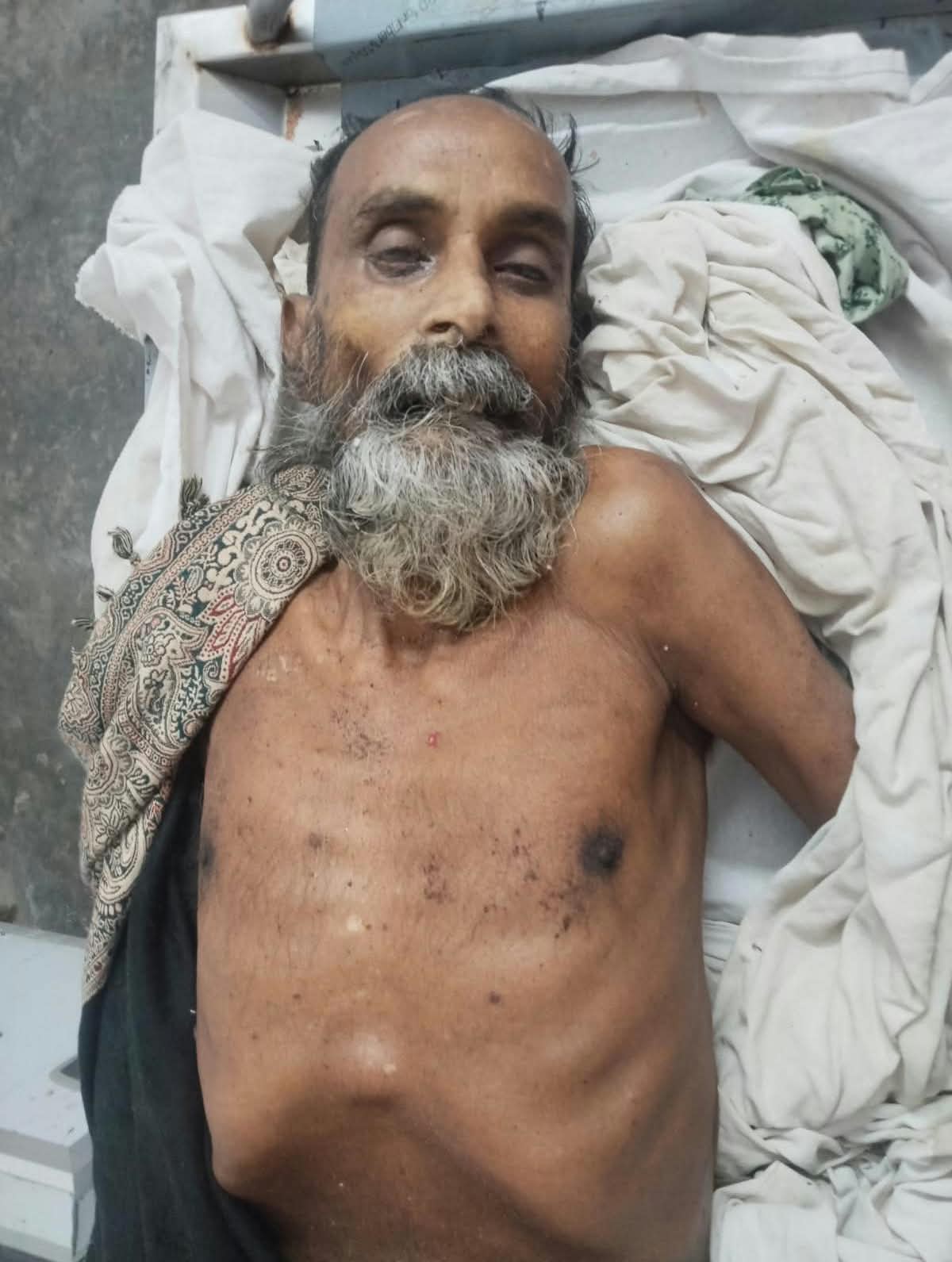 অজ্ঞাতনামা ব্যাক্তির পরিচয় সনাক্ত করতে চায় পুলিশ