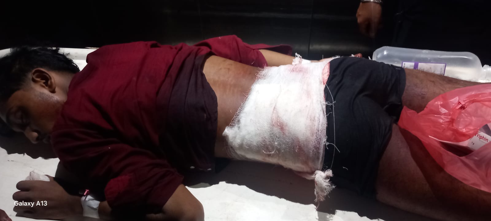 মির্জাজাঙ্গালে প্রকাশ্যে যুবককে কুপিয়ে জখম, ওটিতে দীপ্ত