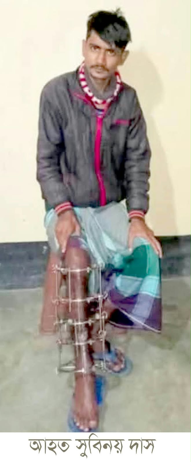 সুনামগঞ্জে সড়ক র্দূঘটনায় গুরুতর আহত মোটর সাইকেল চালক সুবিনয়ের অপারেশনের জন্য দু”লাখ টাকা আর্থিক সহায়তার আবেদন